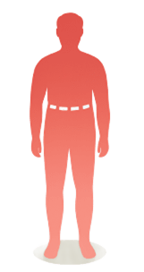 BMI Calculator - Grade I Obesity